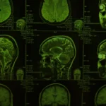 Illustration of an aging brain with glowing neural connections symbolizing mental sharpness and cognitive health