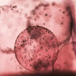 Michigan health alert about the Cyclospora outbreak and the first two confirmed deaths